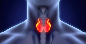 Treating Stage 4 Thyroid Cancer With Graviola and Ozone