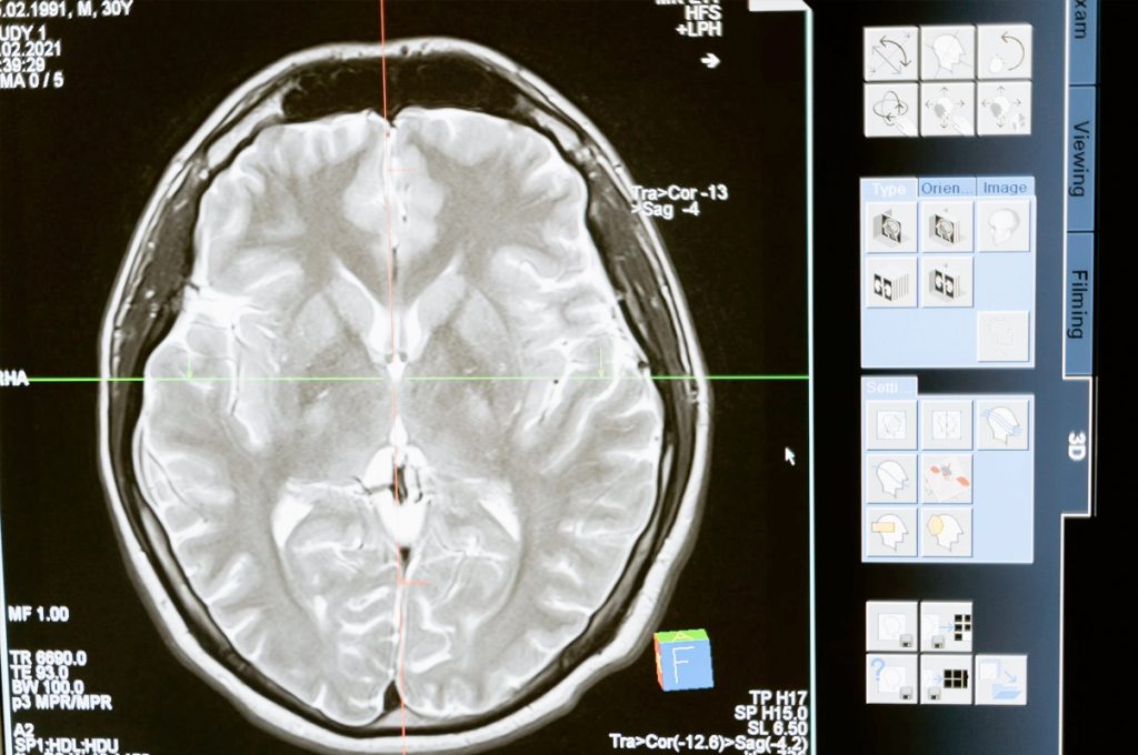 How to improve the results of radiotherapy with fewer side effects